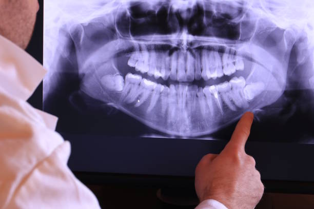 Emergency Gum Pain Relief in SC